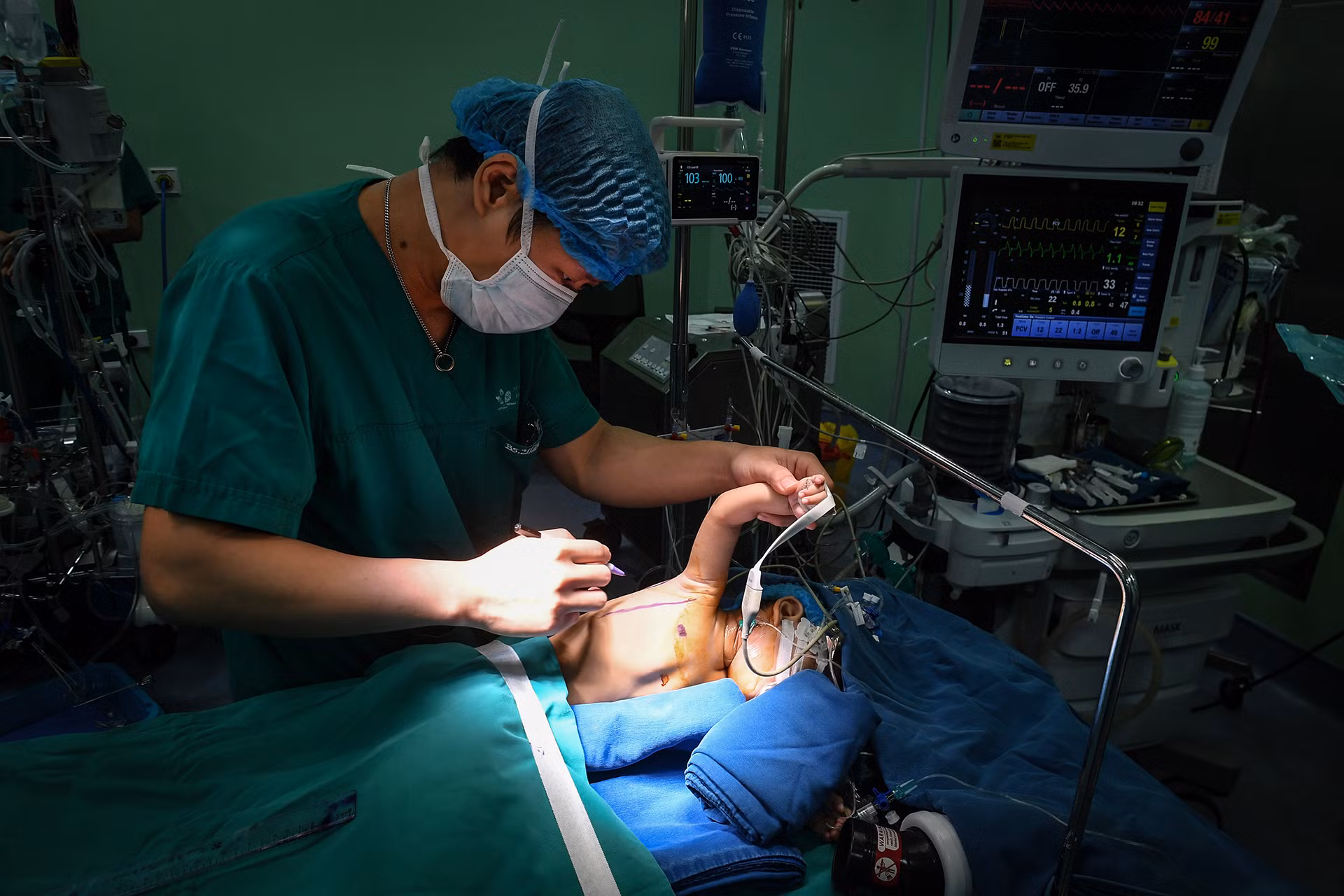 [Ảnh] Cận cảnh ca mổ thứ 700 trường hợp tim bẩm sinh với kỹ thuật ít xâm lấn ảnh 5