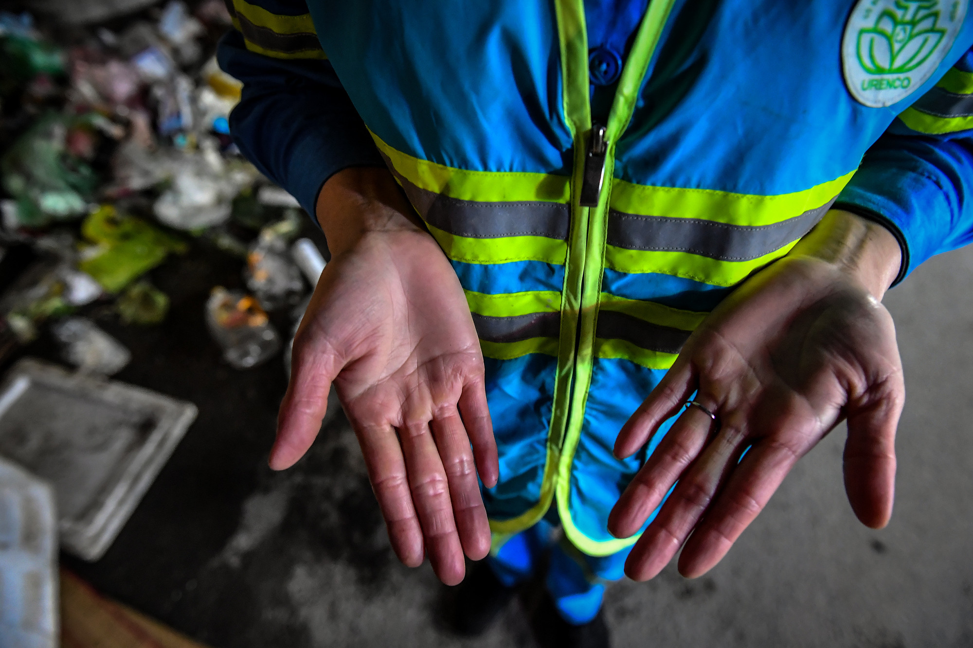 Bàn tay chị Nhàn đỏ lựng và phồng rộp vì giá rét. Bàn tay chị Nhàn đỏ lựng và phồng rộp vì giá rét.