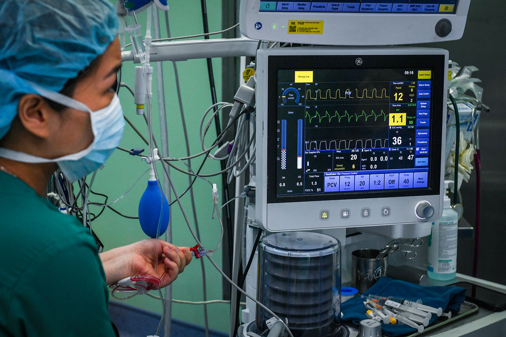 [Ảnh] Cận cảnh ca mổ thứ 700 trường hợp tim bẩm sinh với kỹ thuật ít xâm lấn ảnh 3