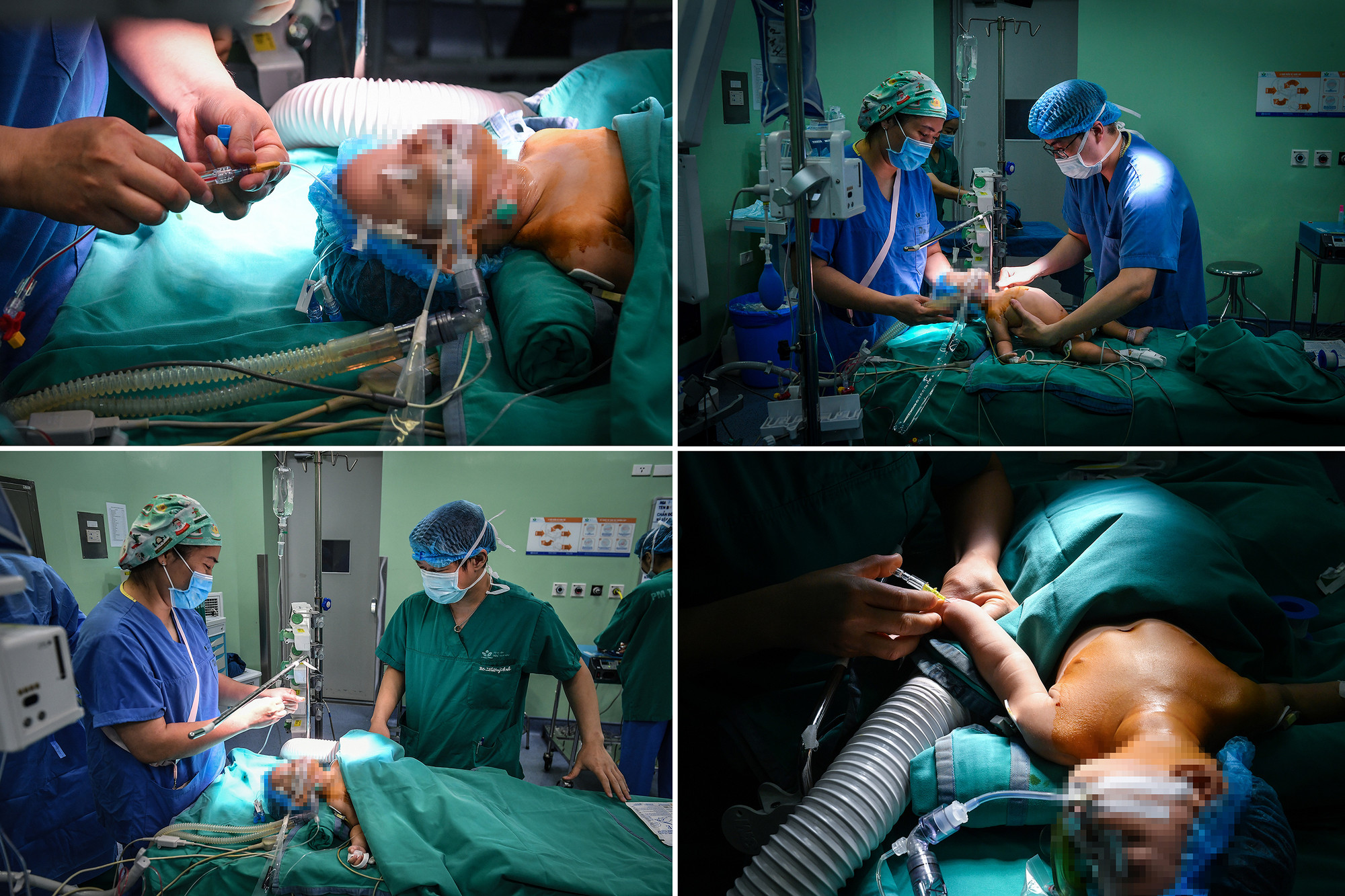 [Ảnh] Cận cảnh ca mổ thứ 700 trường hợp tim bẩm sinh với kỹ thuật ít xâm lấn ảnh 4