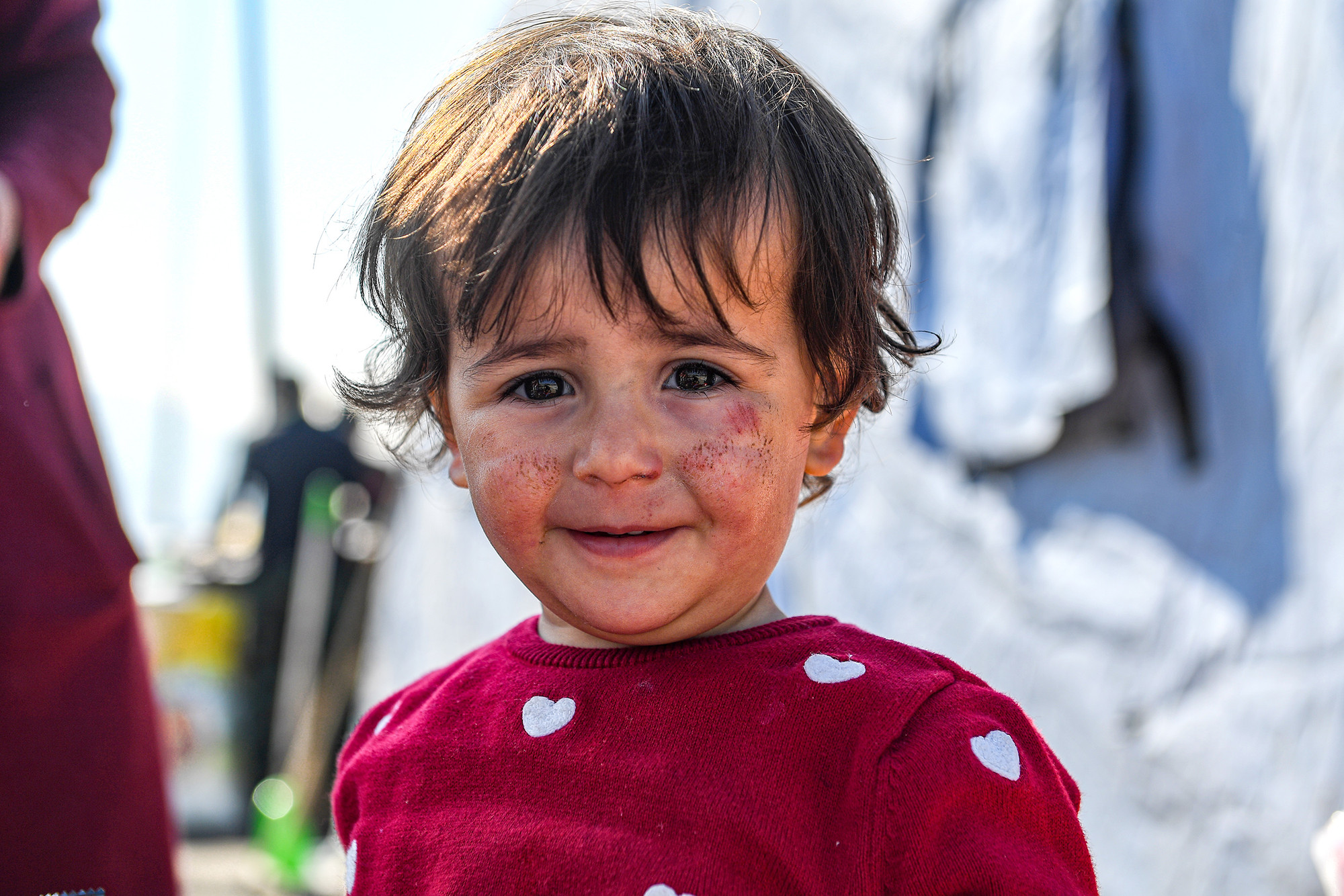 Nụ cười thiên thần của bé Marie (người Syria) mới 2 tuổi, trên má em đã dần khỏi những vết xước sau trận động đất để lại.