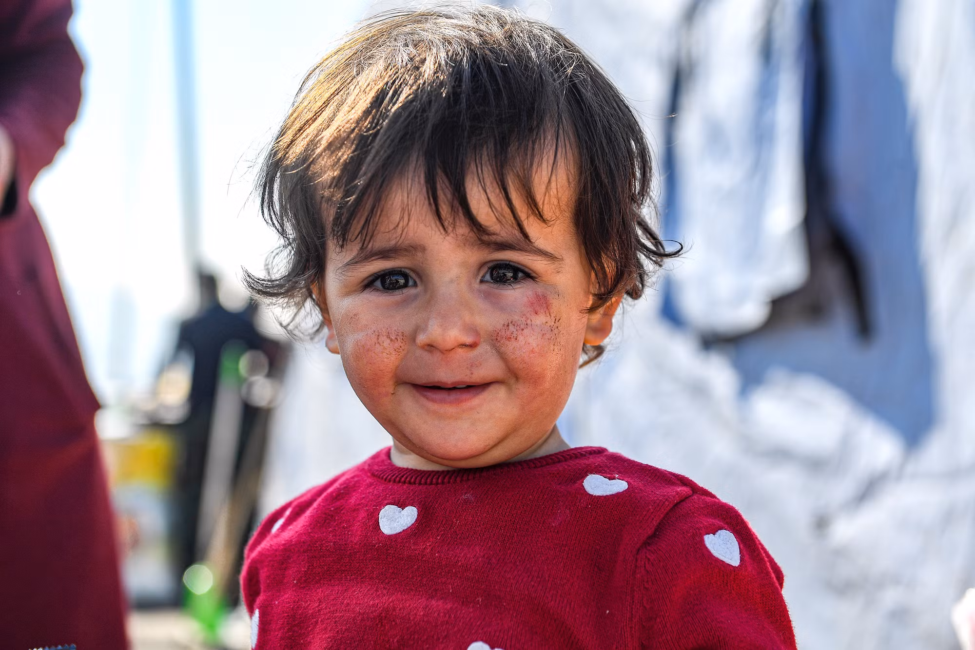 Nụ cười thiên thần của bé Marie (người Syria) mới 2 tuổi, trên má em đã dần khỏi những vết xước sau trận động đất để lại. Nụ cười thiên thần của bé Marie (người Syria) mới 2 tuổi, trên má em đã dần khỏi những vết xước sau trận động đất để lại.