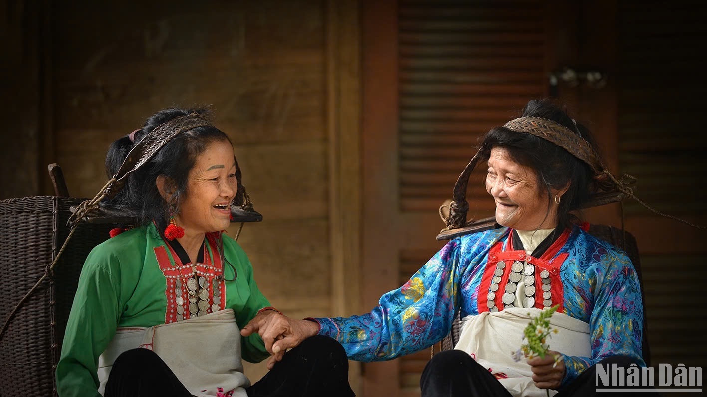 Theo thời gian, các hình xăm quanh miệng mờ dần. (Ảnh: VŨ LINH) Theo thời gian, các hình xăm quanh miệng mờ dần. (Ảnh: VŨ LINH)