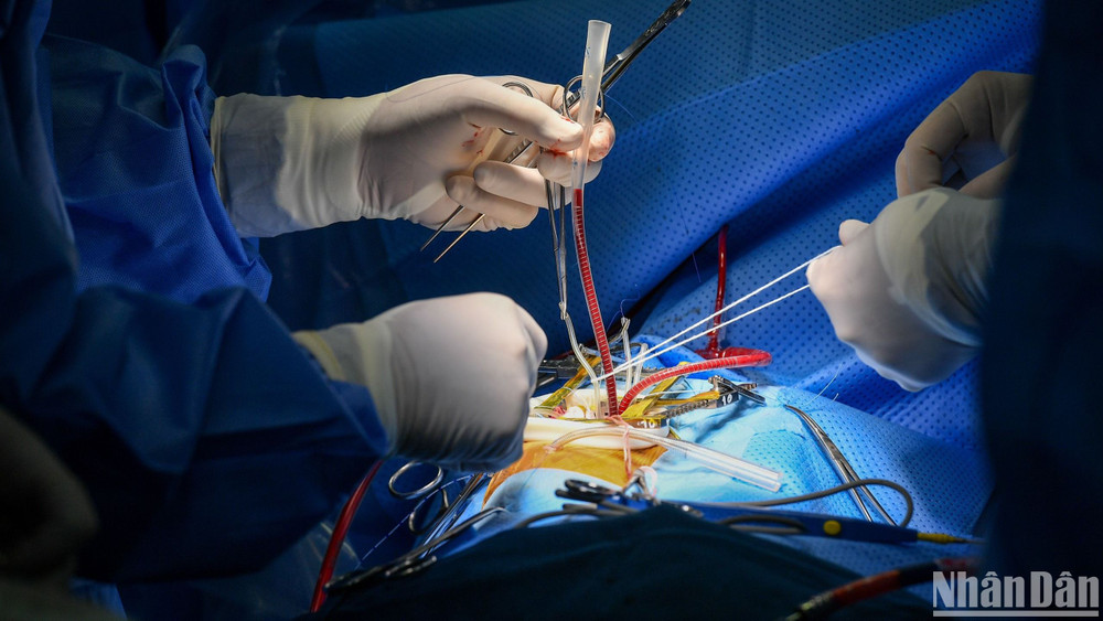 Công Nghệ Laser Trong Phẫu Thuật Tiết Niệu: Bước Tiến Đột Phá