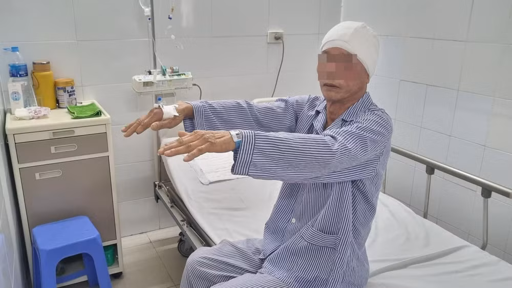Bệnh nhân tỉnh táo, vận động tốt sau mổ 1 ngày.