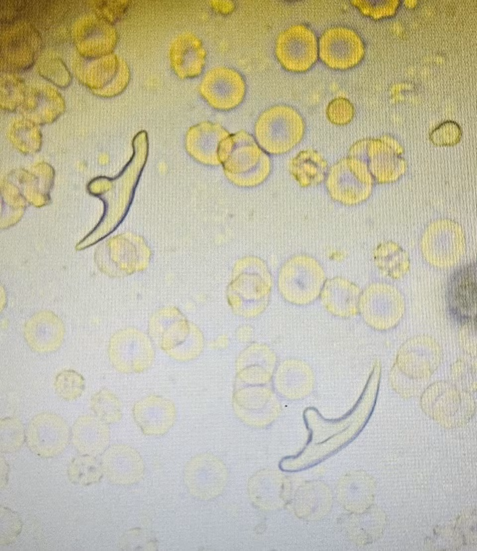 Hình ảnh soi tươi ấu trùng sán dây chó.