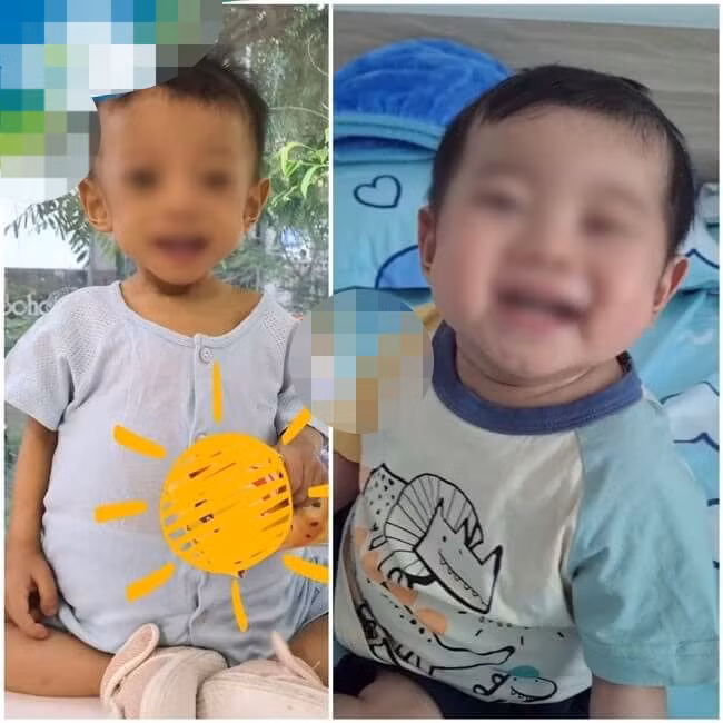 Nhiều bệnh nhi được hồi sinh sau khi được ghép gan.