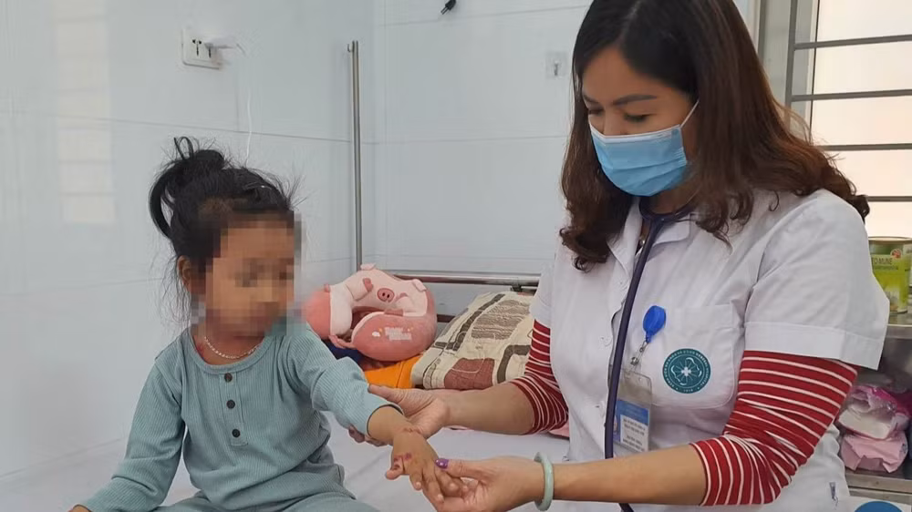 Bác sĩ khám cho bệnh nhi mắc thủy đậu đang nằm viện điều trị. 