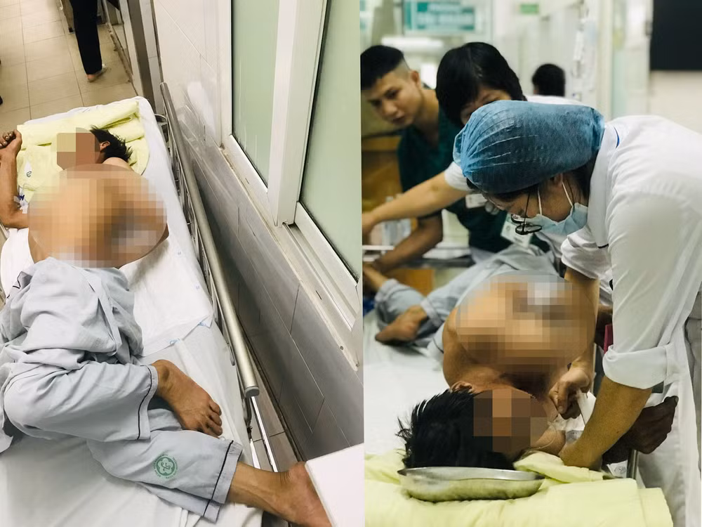 Xử trí cấp cứu cho bệnh nhân uốn ván.