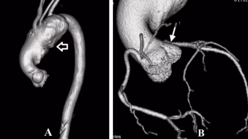 Hình ảnh trước mổ của bệnh nhân.(Ảnh: BVCC)