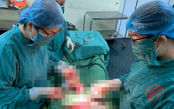 Sản phụ mang thai đôi ở hai tử cung khác nhau