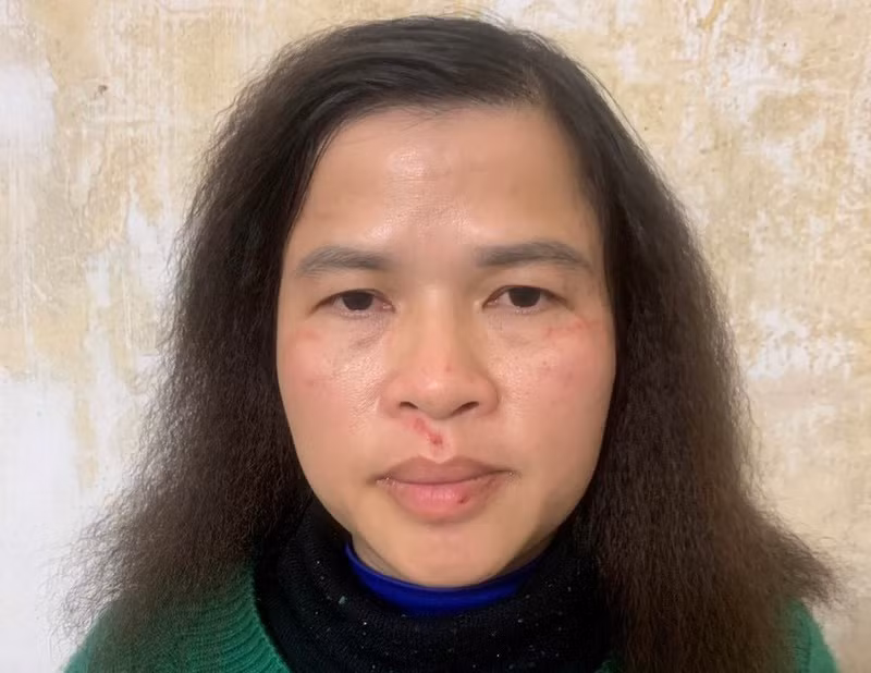 Đối tượng Nguyễn Thị Ái Liên.