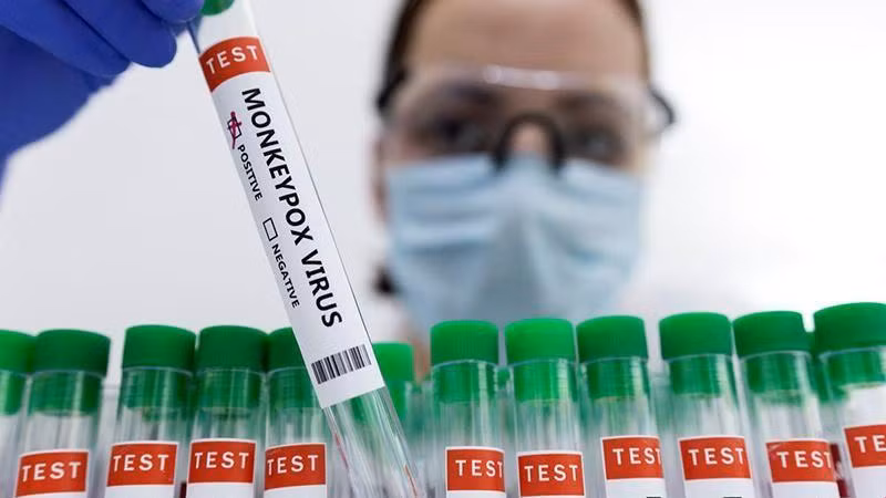 Ống đựng mẫu xét nghiệm dương tính với đậu mùa khỉ. (Ảnh: Reuters)
