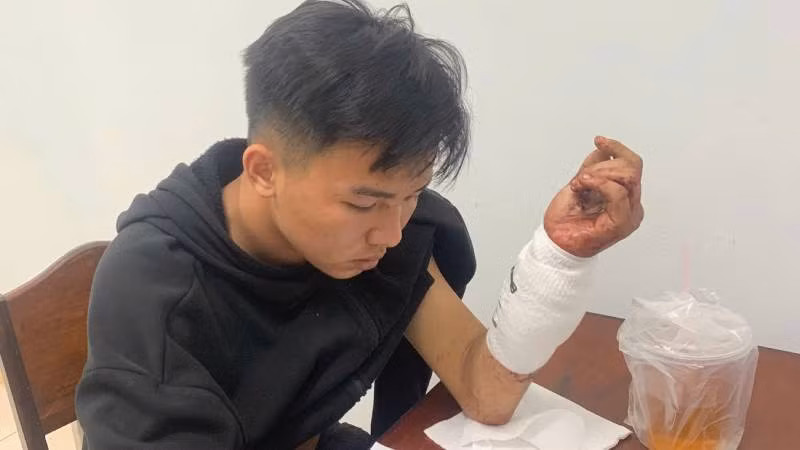 Nghi phạm Đặng Minh Hiền đang bị cơ quan Công an tạm giữ để điều tra hành vi giết người. (Ảnh: HOÀNG TRUNG)