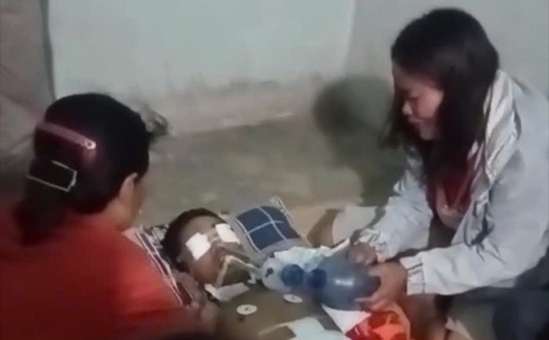Sau 2 tuần được các bác sĩ tận tình cứu chữa, nhưng do vết thương quá nặng khiến em Y Anh Byă đã tử vong.