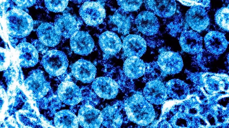 Virus SARS-CoV-2. (Ảnh: AFP/TTXVN)