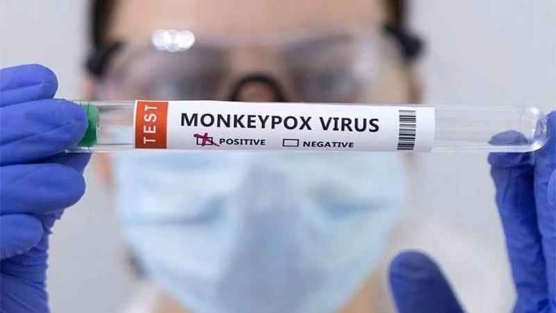 Ống đựng mẫu bệnh phẩm được đánh dấu dương tính với virus gây bệnh đậu mùa khỉ. (Ảnh: Reuters)