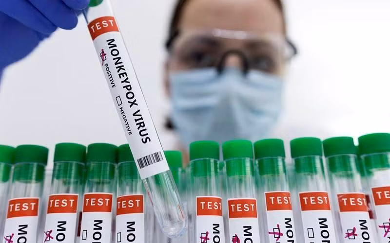 Ống đựng mẫu bệnh phẩm dương tính với virus gây bệnh đậu mùa khỉ. (Ảnh: Reuters)