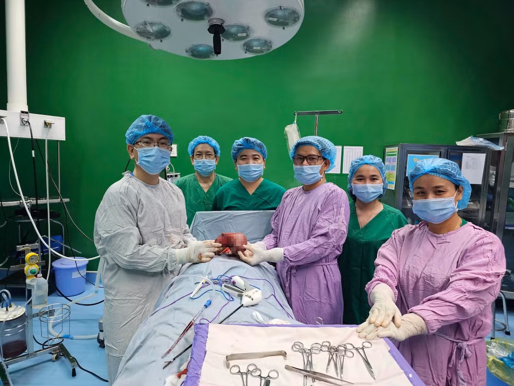Các y bác sĩ đã phẩu thuật tách bóc an toàn khối u nặng 1,5kg.