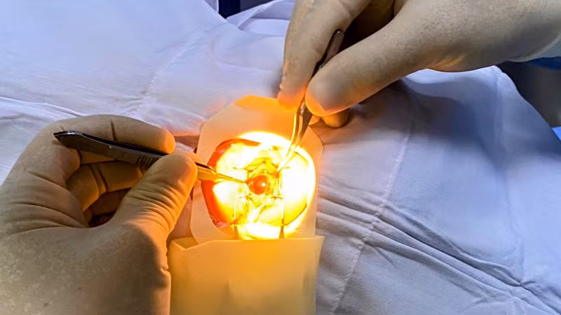 Thực hiện phẫu thuật mắt.