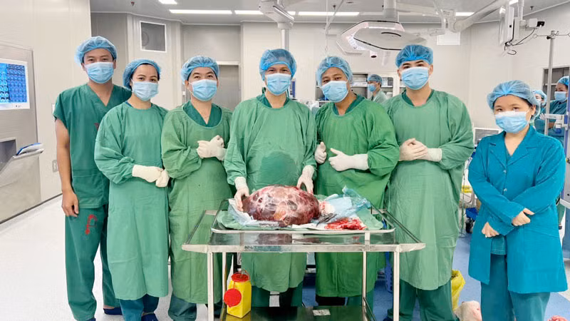 Các y, bác sĩ Bệnh viện Ung bướu tỉnh Kiên Giang phẫu thuật thành công lấy khối u ra khỏi cơ thể bệnh nhân. (Ảnh: BS MƯỜI).