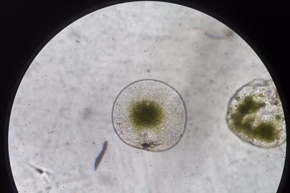 Tảo biển Noctiluca Scintillans được quan sát qua kính hiển vi. Ảnh: Reuters.