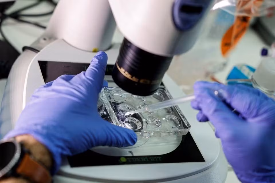 Các mô hình phôi người giai đoạn đầu, do các nhà khoa học Israel tạo ra mà không sử dụng trứng, tinh trùng hoặc tử cung. Ảnh: Reuters