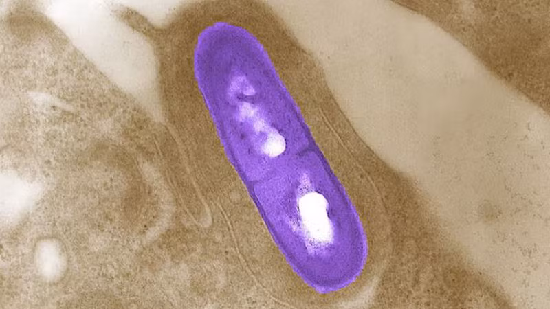 Vi khuẩn Listeria. (Ảnh: Reuters/TTXVN)