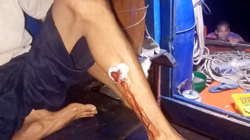 Chân của một ngư dân bị thương tích. (Ảnh: Ngư dân cung cấp)