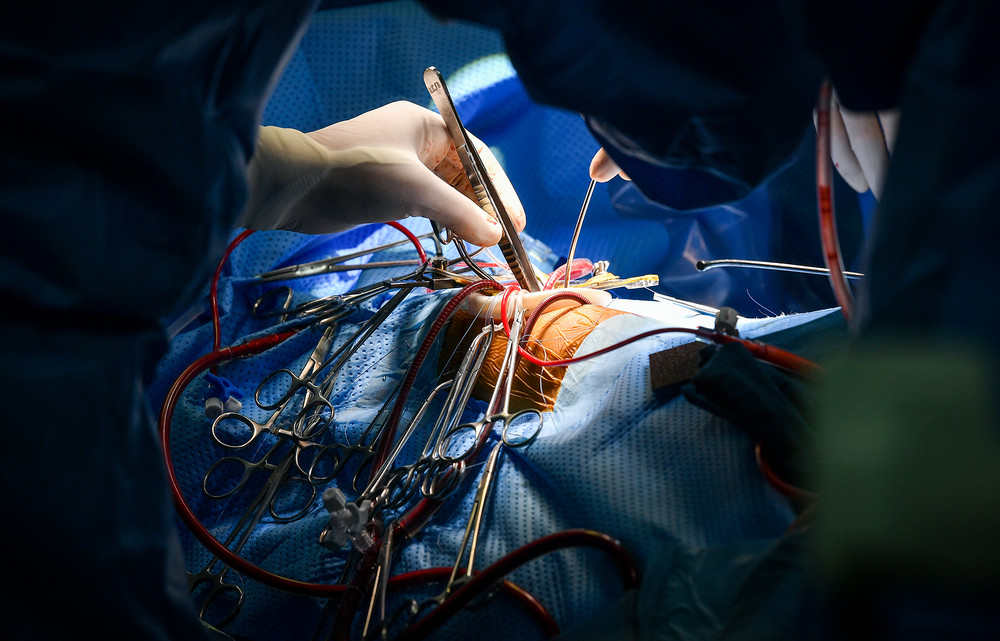 Ảnh] Cận cảnh ca mổ thứ 700 trường hợp tim bẩm sinh với kỹ thuật ít xâm lấn | Báo Nhân Dân điện tử