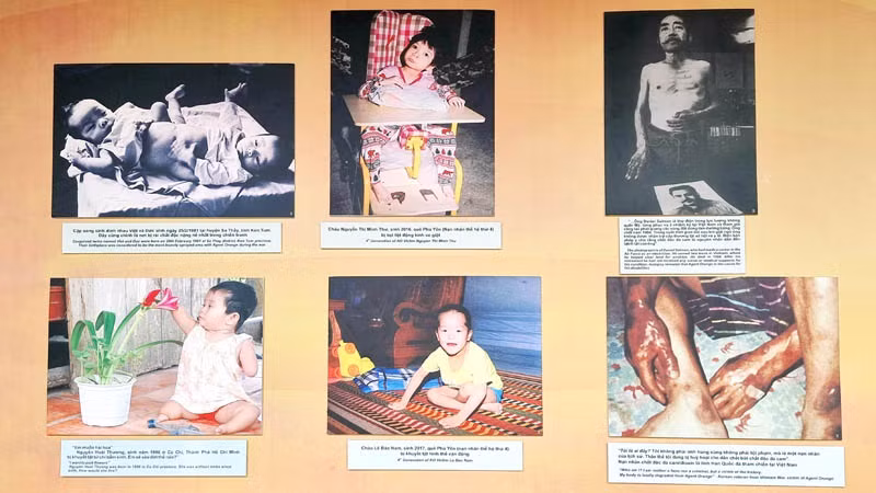 Hình ảnh về nỗi đau da cam ở Việt Nam trưng bày tại triển lãm.