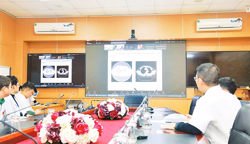 Các bác sĩ Bệnh viện Hữu nghị Việt Đức và Bệnh viện đa khoa Sơn La hội chẩn cấp cứu nạn nhân vụ tai nạn giao thông qua hệ thống Telemedicine.