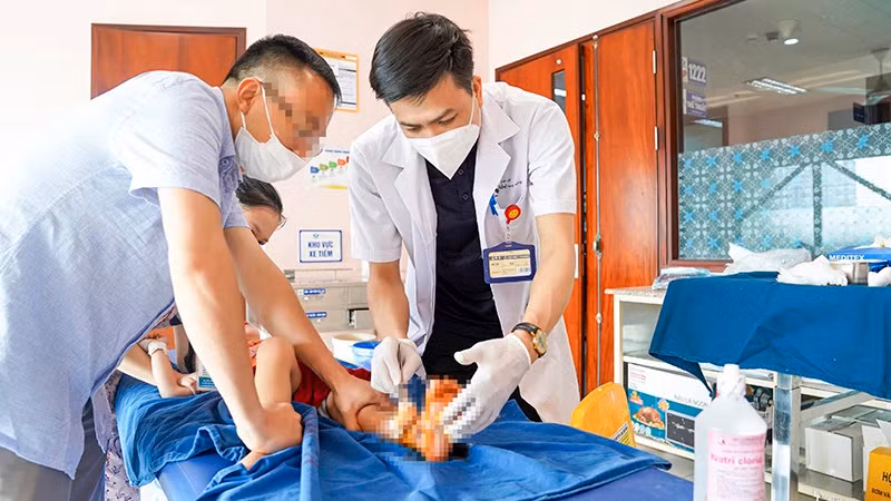 Điều trị cho trẻ em bị tai nạn dập nát chân do cửa trượt tự động tại Bệnh viện Nhi trung ương. (Ảnh VNNCH)