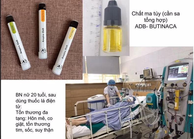 Một bệnh nhân cấp cứu tại Trung tâm chống độc sau khi dùng thuốc lá điện tử có chất ma túy.