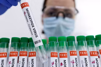 Các ống nghiệm dán nhãn "dương tính với virus đậu mùa khỉ". (Ảnh minh họa: REUTERS)