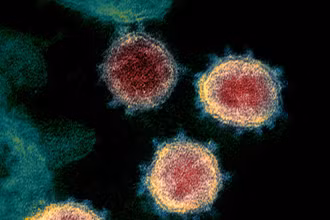 Hình ảnh virus SARS-CoV-2 qua kính hiển vi điện tử. (Ảnh: Reuters)