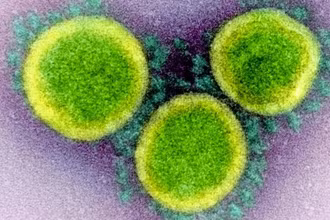 Hình ảnh các hạt virus SARS-CoV-2 qua kính hiển vi điện tử. Ảnh: NIAID.
