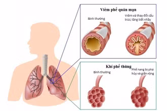 (Ảnh minh họa)