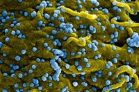 WHO: Ethiopia tuyên bố khống chế được đợt bùng phát virus Marburg