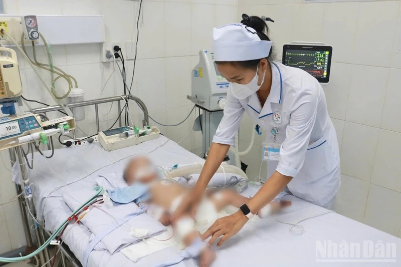 Khánh Hòa cứu sống bệnh nhi mắc tay chân miệng diễn tiến nặng bằng kỹ thuật lọc máu liên tục