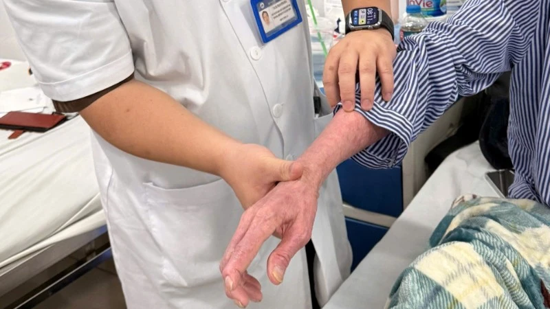 Loại bỏ bệnh da di truyền hiếm gặp nhờ phương pháp điều trị mới