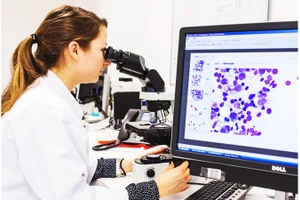 Nghiên cứu điều trị bệnh bạch cầu lymphocytic mãn tính. Ảnh: ALARMY