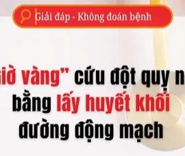 [Video] "Giờ vàng" lấy huyết khối cho bệnh nhân tắc động mạch não lớn