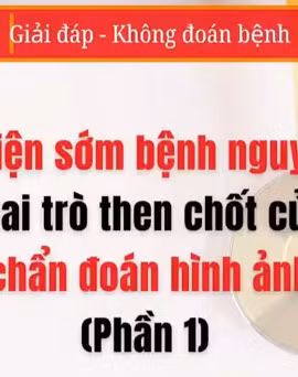 [Video] Phát hiện sớm bệnh nguy hiểm bằng chẩn đoán hình ảnh - Phần 1