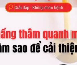 [Video] Làm sao để cải thiện quầng thâm quanh mắt?