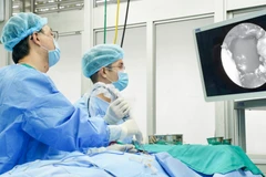 Bác sĩ Bệnh viện Chợ Rẫy sử dụng hệ thống phẫu thuật nội soi thần kinh 4K-ICG cho ca mổ.