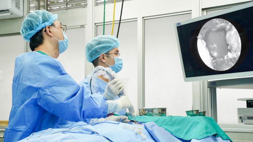 Bác sĩ Bệnh viện Chợ Rẫy sử dụng hệ thống phẫu thuật nội soi thần kinh 4K-ICG cho ca mổ.