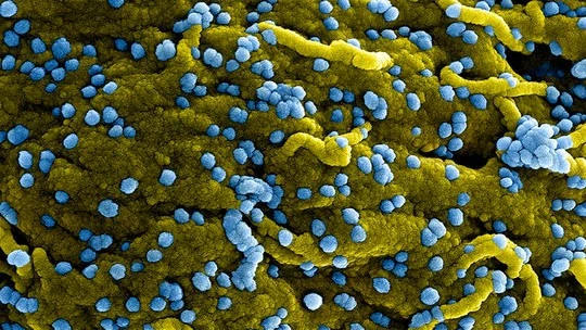 WHO: Ethiopia tuyên bố khống chế được đợt bùng phát virus Marburg