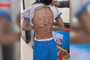 [Video] Bộ Y tế đề nghị lập đường dây nóng 24/7, xử nghiêm mọi hành vi che giấu bạo hành trẻ em