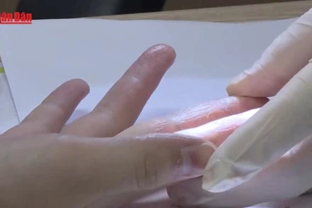 [Video] Cảnh báo gia tăng các bệnh về da trong mùa mưa